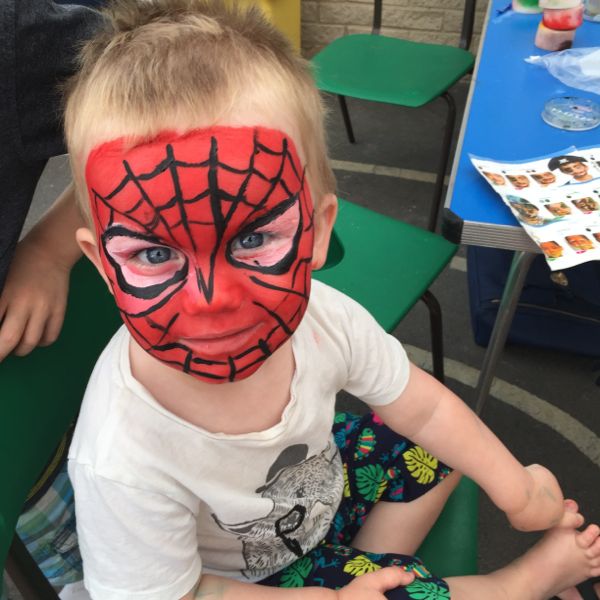 Dealing with an allergic reaction to face paint this summer - Toby and Roo